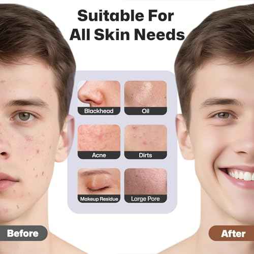 PRITECH Facial Cleansing Brush, Rechargeable Silicone Face Scrubber with Heat Massage End, Vibrating Exfoliator Scrubber for Deep Cleaning, Waterproof Face Brush for Women and Men (Black)