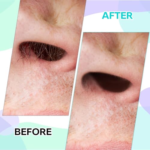100 Pcs Nose Waxing Sticks Plastic Nasal Cleaning Applicators For Painless Nostril Ear And Eyebrow Hair Removal Nose Hair Wax Sticks Nose Wax Applicator Sticks For Nostrils Ears Face Cleaning