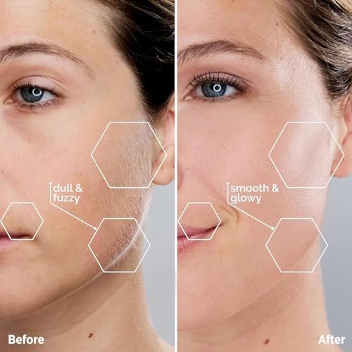 Facial Hair Removal for Women: Electric Face Razor with LED Light - Painless & Instant Results Mini Shaver for Travel Use (Blue)