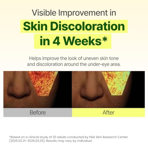 GOODAL Green Tangerine Vitamin C Dark Spot Care Eye Cream | Clinically Tested Dark Circle & Dark Spot Brightening, Improved Elasticity, Gentle & Fragrance-Free Korean Skincare 1.01oz / 30ml