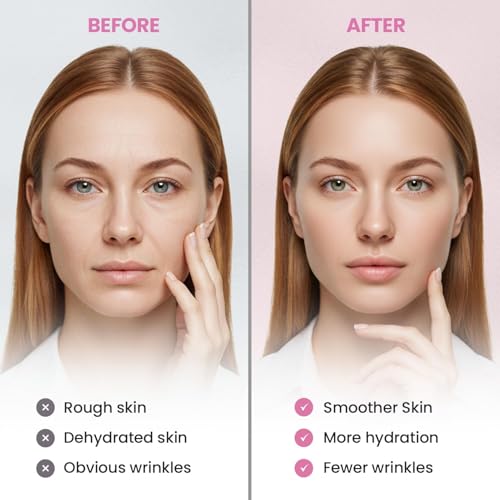 New Anti Facial Wrinkle Patches: Anti Wrinkle Patches Overnight - Smile Line Pathces - Facial Wrinkle Patche for Forehead, Smile Line, Under Eyes (1 Count (Pack of 144))