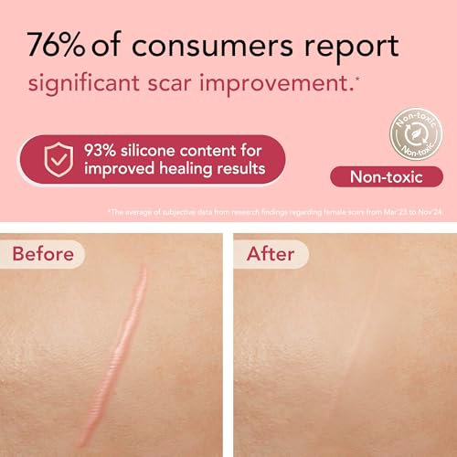 Silicone Scar Sheets (1.6"x 118" Roll-3M) - Silicone Scar Tape for Scar Removal Treatment, Reusable Strips for C-Section, Keloid, Burn, Acne, and Surgical Scars with Folding Scissors