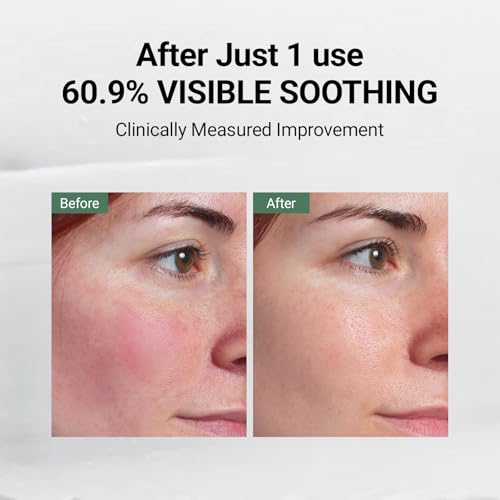 DA EFFECT - Post Care Balm, Advanced Barrier Repair Moisturizer & Hydrating Face Cream with GINSTECAX¢â, Soothes Sensitive Skin, Relieves Redness & Irritation, 30ml