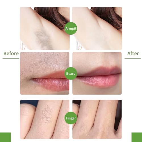 Facial Wax Strips for Women ? 98% Natural Formula, Hypoallergenic for Sensitive Skin ? Face Wax Strip for Hair Removal, Gentle & Quick Eyebrow Wax Strips for Upper Lip, Chin, Legs & Bikini Line