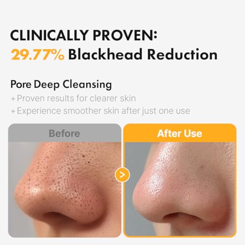 Hanskin Pore Cleansing Oil, Oil Cleanser for Face, Makeup Blackhead Remover, Korean Cleanser for Sensitive Skin (6.76 oz (Pack of 1))