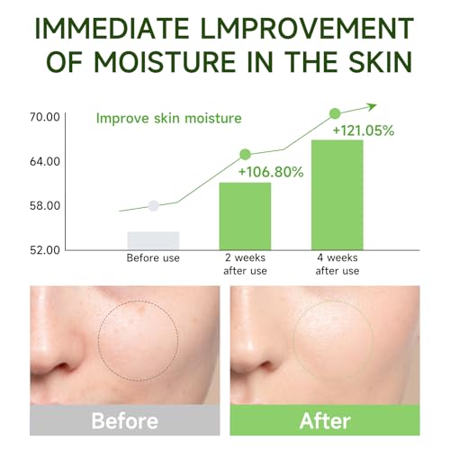 Centella Asiatica Serum Centella Tea Tree Ampoule Facial Serum Korean Centella Serum for Acne-Prone Oil Skin Soothing, Calming, Reduce Redness 105ml