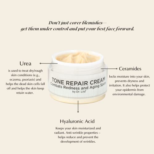 EPILYNX Tone Repair Moisturizer For Dark Spots on Face - Gluten Free, Vegan for Sensitive Skin by Dr. Liia