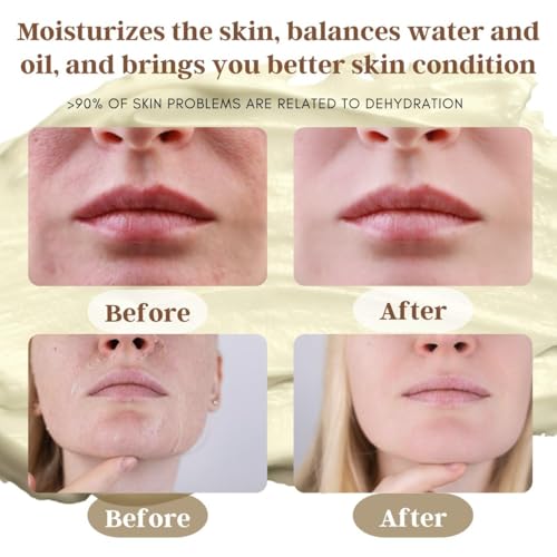 100% Grass-Fed Beef Tallow Balm, Manuka Honey MGO 263+, Organic Beeswax & Olive Oil, Beef Tallow for skin,Handmade Moisturizer for Dry Skin, Eczema Relief, & Healing Skin(2oz)