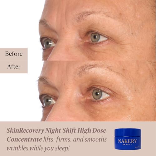 Nakery Night Shift Overnight Face Cream, Retinol Sleep Repair Cream with Methylene Blue, NAD+, and Melatonin, Anti-Aging Night Moisturizer for Fine Lines, Collagen Boost, and Cellular Renewal