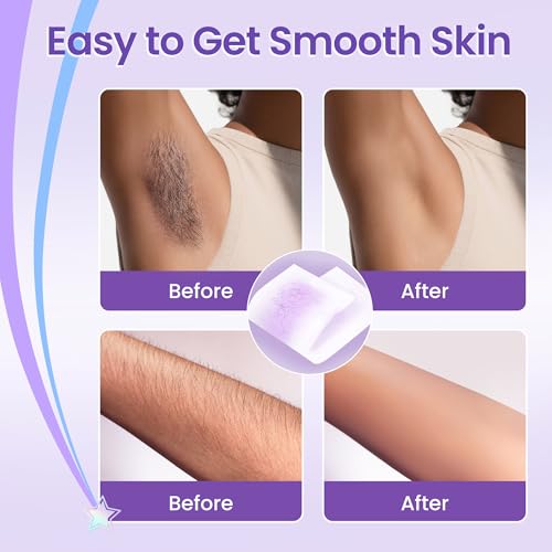 Roll On Wax Hair Removal, Wax Roller Refill, Sticky, Roll on Wax Roller Cartridge for Larger Areas of the Body for Professional or Home uses 4 Pack 100g/3.527oz with 10 oil wipes