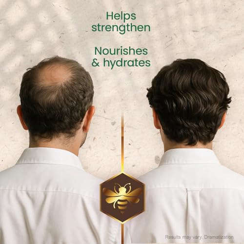 Tio Nacho Mexican Herbs Shampoo, Strengthening, Anti Hair Loss & Anti Breakage with Royal Jelly, Ginseng & Jojoba, Paraben & Cruelty Free, 32 Fl Oz