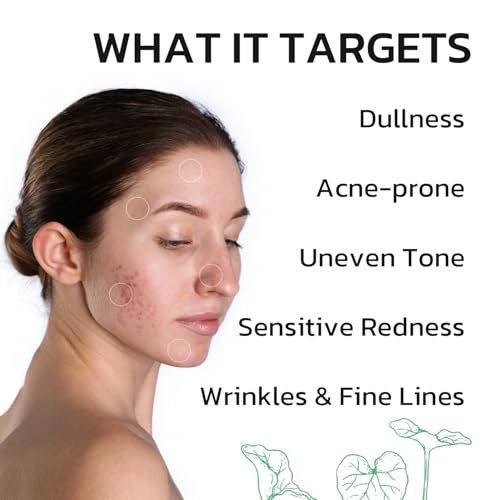 PDRN Cream Centella Moisturizer Phytocin Salmon Cream Face Soothing Hydration Barrier Repair Calming, for Acne Prone & Sensitive Skin with Ceramide, B5 (30ml)