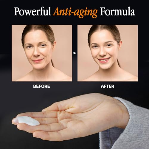 Triple Lipid-Peptide Cream: Enriched with Lipids, Ceramides, Peptides, Hyaluronic Acid, and Fatty Acid for Firming, Anti-Aging and Plumping Face Moisturizer (53 ml /1.8 fl oz)