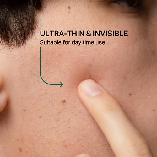 Y¡¯OUR Improving Acne Patches: Ultra-thin Hydrocolloid Healing Pimple Patch for Face; Purifies & Alleviates Stubborn Blemishes, Effective Zit Treatment. 56 Count. Gifts for Her
