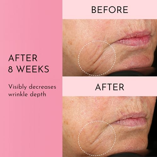 Lawless Forget the Filler Skin-Plumping Line-Smoothing Perfecting Cream - Premium Non-Acne Moisturizer Designed to Prime, Plump, Smooth, and Tighten Skin for a Youthful, Hydrating Look - 1.7 oz