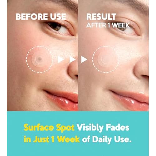 Troubless Micro Patch Plus Vitamin C - Zit Hydrocolloid Patch for Stubborn Marks with 10% Vitamin C - Micro-Dissolving Pyramids for High-Absorption, Seamless Adhesion & Easy-Wear (9 EA)