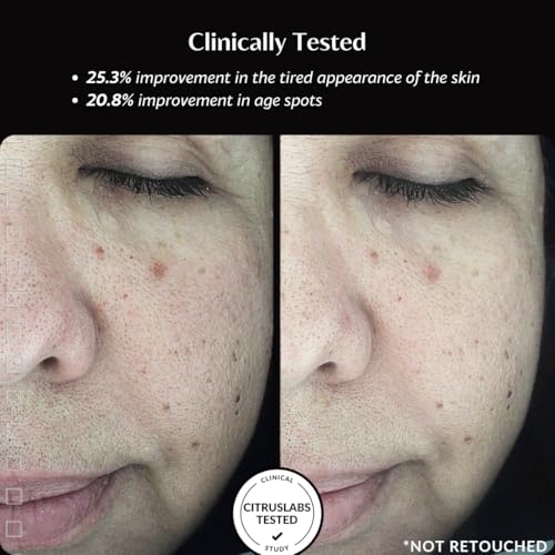 Thursty Skin Hydrating Fluid | Anti-Aging Face Serum with 5 Types of Hyaluronic Acid & Rambutan | Deep Hydration Targets Collagen Skin Renewal Firming & Radiance - Clinically Tested -10ml