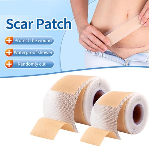 Medical Grade Silicone Scar Sheets 1.6"x 157" Roll-4M Keloid Scars Removal C-Section Scar Strip Painless Treatment Resuable Tummy Tuck Tape Professional for Surgical Incision,Acne,Burn Scar