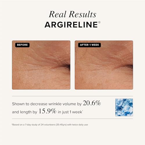 TruSkin Hyaluronic Acid Serum for Face ? 7 Ultra-Hydrating Ingredients ? Moisturizing & Plumping Facial Serum for Smooth, Healthy-Looking Skin, 1 Fl Oz