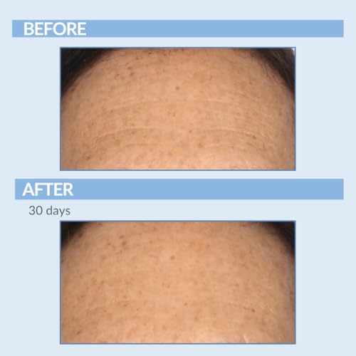 Serious Skincare A Force XR Serum Retinol Concentrate - Vitamin A - Time Released ? Lightweight Anti-Aging & Anti-Wrinkle Facial Treatment ? Green Tea Leaf Extract - 2 oz.