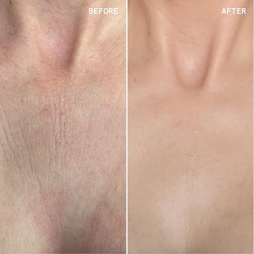 Beauty Pie ?ber Youth Neck & Chest Super Lift Serum-Spray ? Anti-Aging, Firming & Hydrating Treatment for Smooth, Youthful Skin