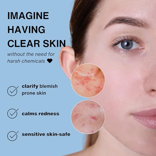 Hypochlorous Acid Spray ? 3.4oz Travel Size HOCl Facial Mist & Daily Cleanser for Sensitive Skin | Clarifying & Calming Toner for Redness, Irritation & Breakout-Prone Skin