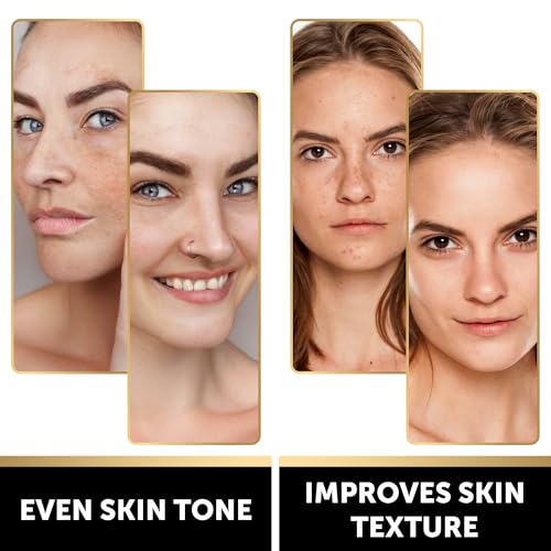 VALITIC Lemon Turmeric Soap for Dark Spots - Kojic Acid Soap for Face and Body - Exfoliating Bar for Brightening, Skin Tone Corrector with Retinol, Vitamin C, Collagen and Hyaluronic Acid - 1 Pack