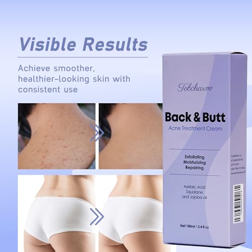 SOME BY MI 30 Days Miracle Clear Spot Patch - Pack of 5, 90 Counts, 2 Size(10mm 45Counts, 12mm 45Counts) - Invisible Hydrocolloid Skin Trouble and Pimple Patch with No Irritation - Korean Skin Care