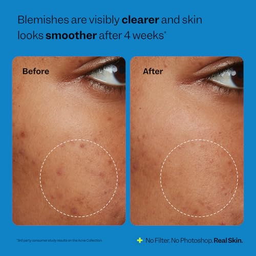 Peach Slices Oil-Free Moisturizer with 2% Salicylic Acid & Hyaluronic Acid - 2.82 oz with Niacinamide, Cica - Vegan, Cruelty Free Korean Skincare
