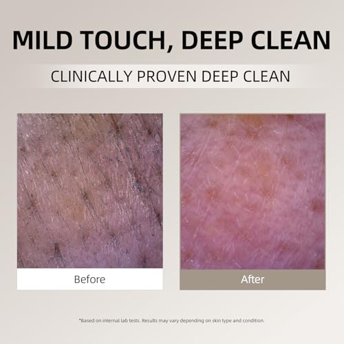 DEEOM Real Yam Brightening Cleanser, Gentle Foaming Face Wash for Sensitive Skin with Rice Water, Hydrating & Deep Pore Cleansing, Korean Skincare, 6.76 oz