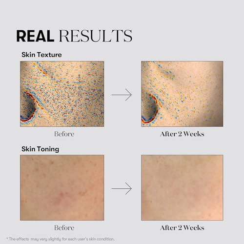 VT COSMETICS TX Toning Facial Toner with Tranexamic Acid, Niacinamide, Glutathione, Hydrating, Refreshing Toner for Dark Spots, Acne Scar, Sun Spots, Age Spots, Korean Skin Care (6.76 fl. oz.)