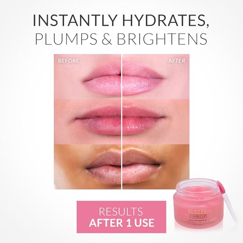 ELSZ?E Loveable Lips | Lip Mask with Hyaluronic Acid | Smooth, Volumize and Hydrate Dry Lips | Day & Night Treatment