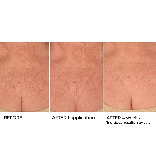 NassifMD Age Defying Neck & D?collet? Serum, Lifts and Firms Thin Neck Skin, Hydrates and Smooths