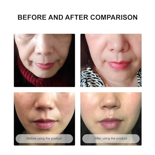Anti Wrinkle Patches to Remove Face Wrinkles Treatment,Smooth Nasolabial Folds Wrinkle Patches Face Masks Beauty Product