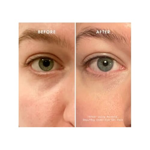 Beauty Pie Depuffing Under-Eye Gel Pads To Tackle Dark Circles & Puffiness