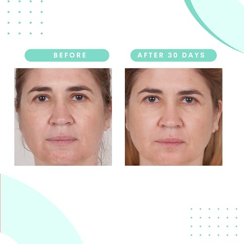 Serious Skincare Glycolic Gommage Extreme Renewal Facial Mask for Radiant Skin - Glycolic Acid - Micro Exfoliation Facial Treatment Mask - Decongest Clogged Pores - 4.5 oz (1Pack)