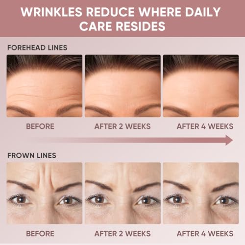 Forehead Wrinkle Patches | Reusable Overnight Smoothing Patches with Lavender Oil | Anti-Wrinkle Silicone Face Tape to Reduce Fine Lines, Prevent Creases | Non-Invasive Facial Pads | Pack of 4