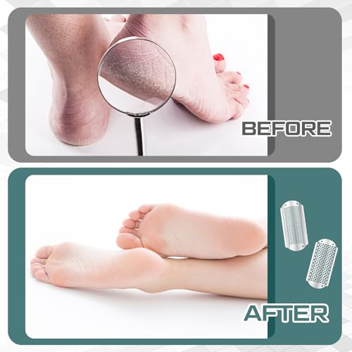 Moxweyeni 14 Pack Colossal Foot File Pedicure Tools Sets with 2 Styles Large and Small Hole Replacement Callus Remover Blades, Stainless Steel Detachable Pedicure Foot Rasp for Dead Skin Remover