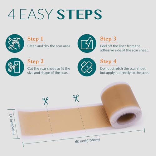 Silicone Scar Tape, Silicone Scar Sheets, Scar Tape for Surgical Scars, Silicone Tape for Scars, Scar Sheets for Surgical Scars, C-Section, Tummy Tuck and Keloid (1.6"x 60" Roll-1.5M)