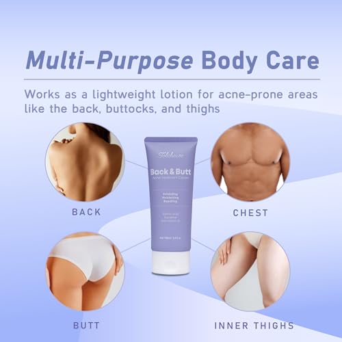 SOME BY MI 30 Days Miracle Clear Spot Patch - Pack of 5, 90 Counts, 2 Size(10mm 45Counts, 12mm 45Counts) - Invisible Hydrocolloid Skin Trouble and Pimple Patch with No Irritation - Korean Skin Care