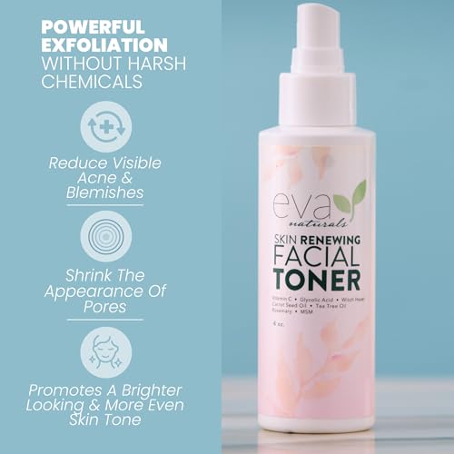 Eva Naturals Witch Hazel Face Toner ? Hydrating & Clarifying Toner with Glycolic Acid, Vitamin C & Aloe for Acne, Oily, Dry & Sensitive Skin, Pore Tightening Facial Mist for Balanced Glow (4oz)