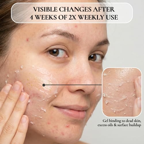 TruSkin Vitamin C Face Wash Cleanser - Brightening Facial Cleanser with Vitamins C & E, Rosehip Oil & Aloe - Gently Cleanses & Refreshes for Radiant-Looking Skin, 5 fl oz