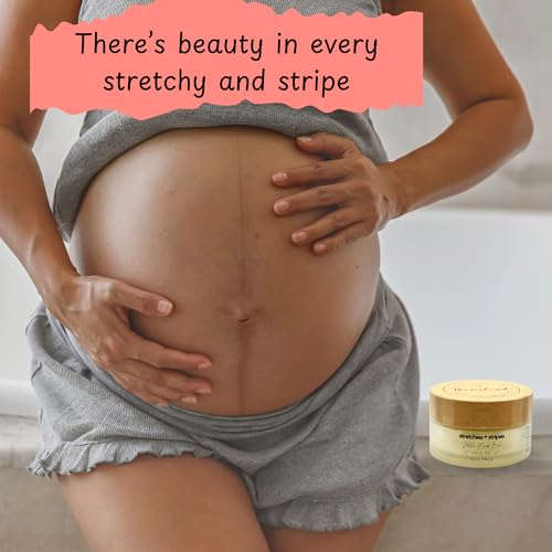 Stretchies and Stripes Stretch Mark Balm | Intense Relief | Pregnancy Safe