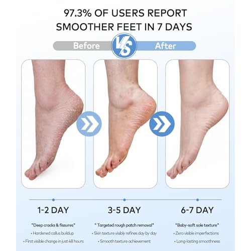 Rechargeable Electric Callus Remover for Feet with Vacuum, Pumice Stone Foot File for 100% Full Foot Care Coverage, 2-Speed & 3 Grinding Heads, Ideal Gift for Dead, Hard Cracked Dry Skin, Black