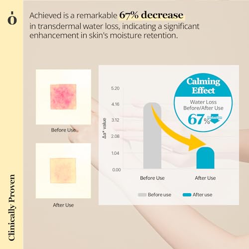 ONGREDIENTS Skin Barrier Lotion + Calming Toner I Hydrating, Soothing, Calming, Skin Barrier Care for Dry, Sensitive Skin I Vegan, Korean Skin Care