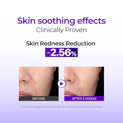 IZEZE Hyper CGA Cica Cream 1.69 fl.oz, 50 ml | Centella Asiatica for Calming, Korean Skincare Cream for Soothing, Acne Prone Skin, Low Irritation for Sensitive Skin, Skincare Coreano