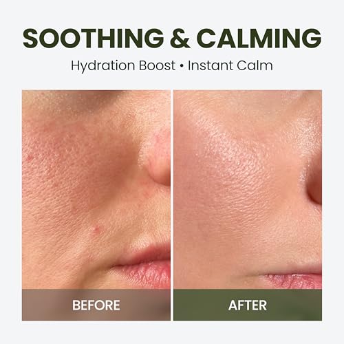 HyCicaMue Green Face Mist | Ultra-Fine Face Spray for Instant Calming & Moisturizing | Cica, Peptide, Ceramide, Hyaluronic Acid | Reduce Excess Sebum & Soothe Irritated Skin | Korean Skin Care
