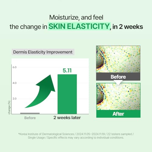 Zipiderm EGF Skin Barrier Intensive Cream ? Korean Hydrating Moisturizer for Dry & Sensitive Skin | Ceramides & Panthenol | Lightweight Nourishing Face Cream | 2.70 fl oz