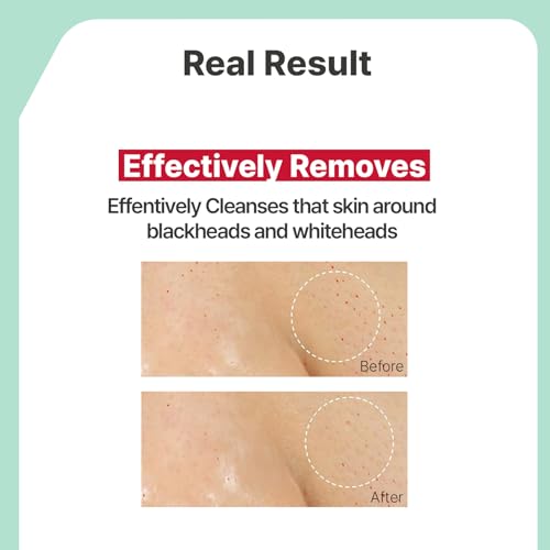 Illiyoon Gentle Deep Cleansing Oil | Lightweight Facial Cleanser with Coconut Oil & AHA/BHA for Makeup, Fragrance-Free, Sebum & Blackhead Removal, Korean Skin Care, 8.45 fl.oz.