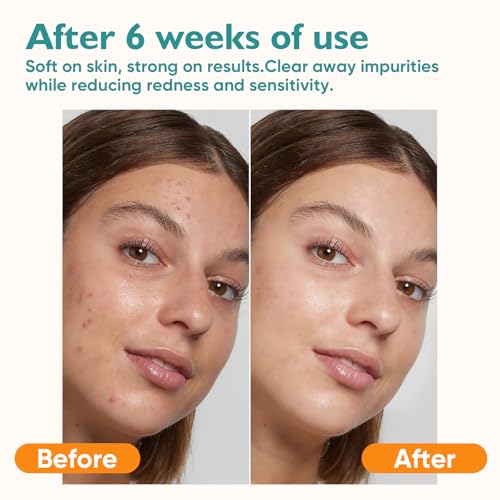 e.l.f. SKIN Bright + Brew-tiful Eye Cream Mini, Helps Brighten Appearance Of Undereye Dark Circles & Repair Puffiness, Vegan & Cruelty-Free